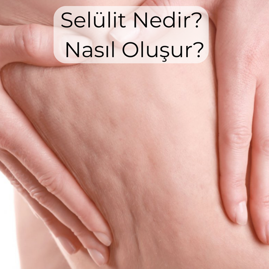 Selülit Nedir ve Nasıl Oluşur?