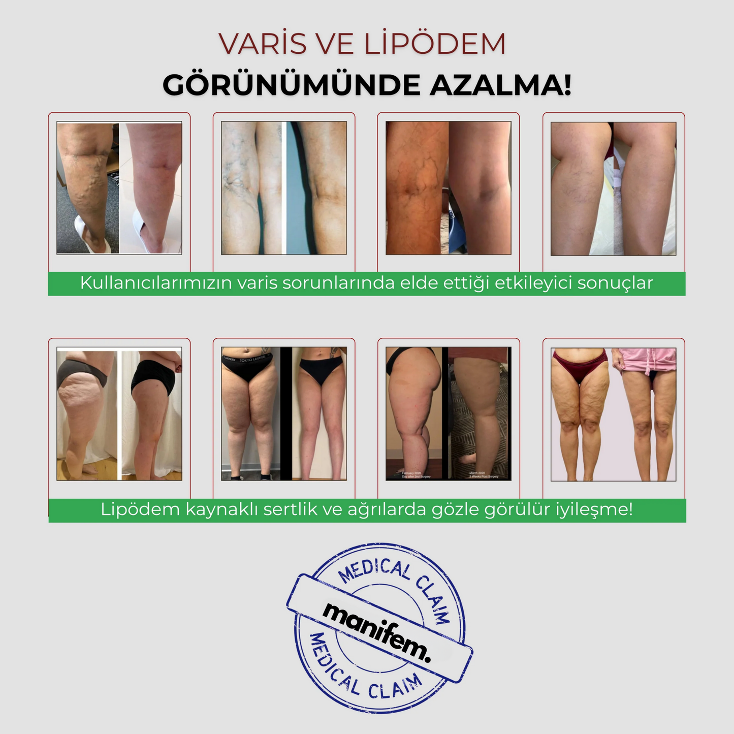 Manifem Anti-Selülit Spor Tayt
